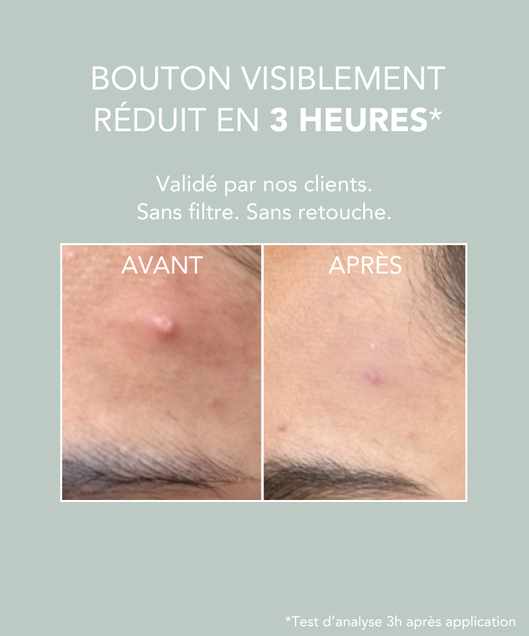 Duo "Anti-Imperfections"